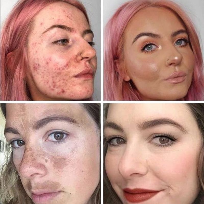 Base Correctora Moisture - Cubre Manchas, Arrugas y Acné, Mientras Hidrata y Nutre - Todo Tipo de Piel